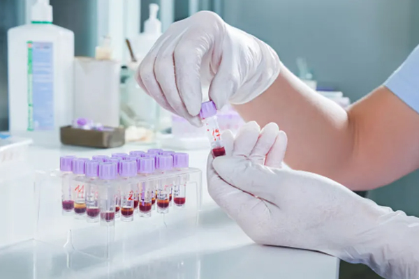 diabetes laboratory